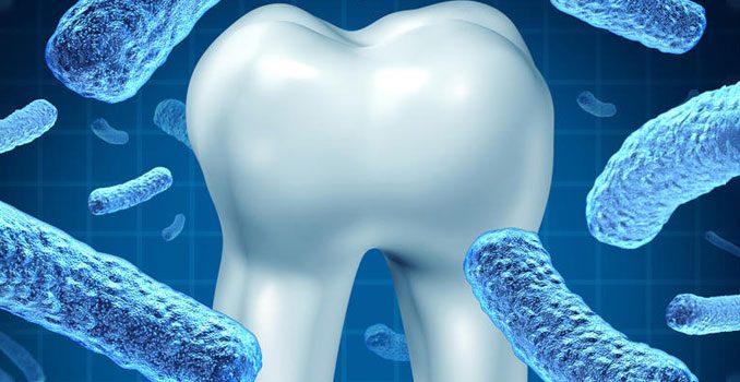Bactérias da placa dental podem provocar coágulos sanguíneos
