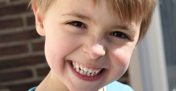 Dentes de leite – A importância da primeira dentição