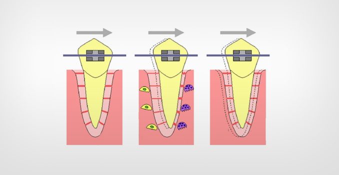 Quais são as etapas do tratamento ortodôntico? – Oral Dente